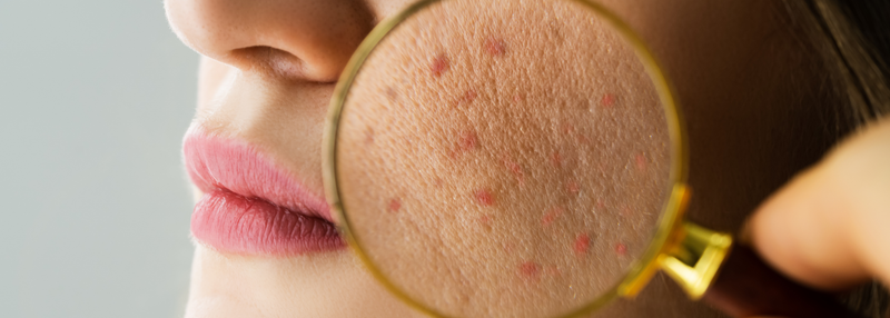 Why Your Skin Barrier Matters More Than You Think